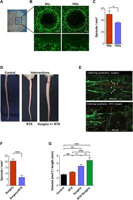 Radiation therapy attenuates lymphatic vessel repair by reducing VEGFR-3 signalling